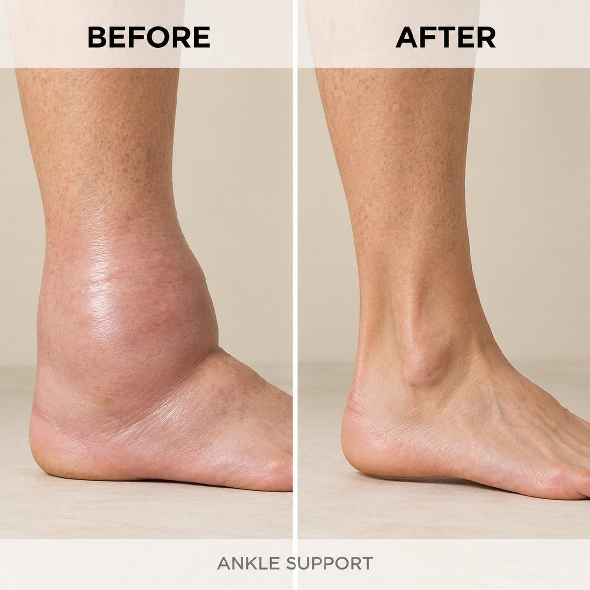 Diosmin & Hesperidin Capsules | Natural Swollen Leg & Ankles Support
